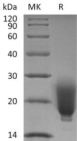 Recombinant Human/Mouse/Rat Irisin/FNDC5 (N-6His) - ABMIUM
