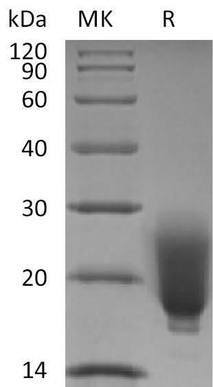 Recombinant Human/Mouse/Rat Irisin/FNDC5 (N-6His) - ABMIUM