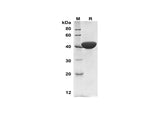 SDS-PAGE analysis of Human ATP6AP2 proteins,2 μg/lane of Recombinant Human ATP6AP2 proteins,was resolved with SDS-PAGE under reducing conditions,showing bands at 41 kDa.