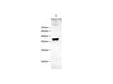 Anti-Rat MCSF Antibody - ABMIUM