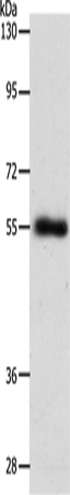 Anti-Human/Mouse SLC1A5 Antibody - ABMIUM