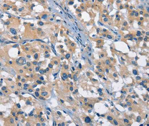 Anti-Human/Mouse GAS2 Antibody