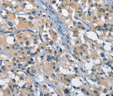 Anti-Human/Mouse GAS2 Antibody - ABMIUM