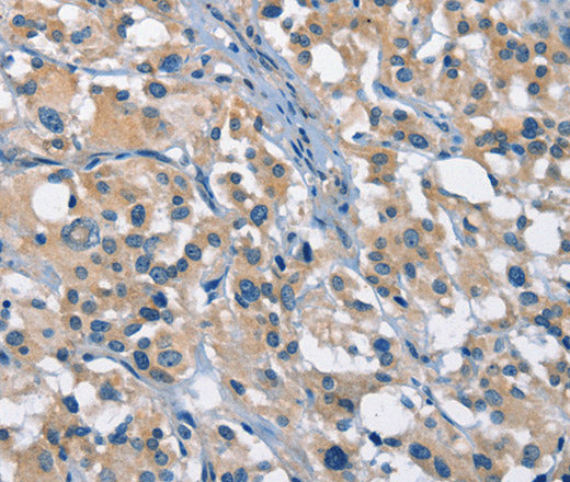 Anti-Human/Mouse GAS2 Antibody - ABMIUM