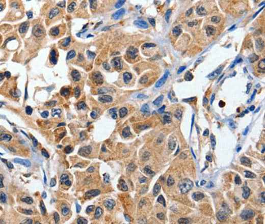 Anti-Human/Mouse DUSP8 Antibody