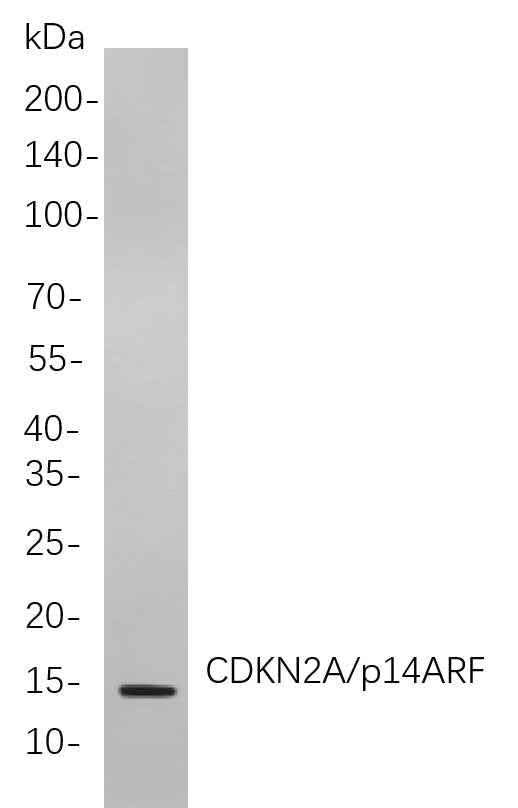 Anti-Human CDKN2A/p14ARF Antibody [B830] - ABMIUM