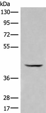 Western blot analysis of Human kidney tissue lysate using BBOX1 Polyclonal Antibody at dilution of 1:650