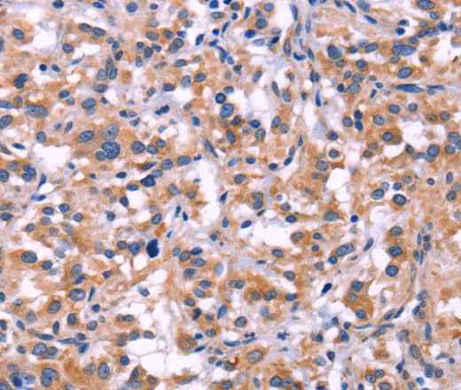 Anti-Human/Mouse/Rat MMP14 Antibody