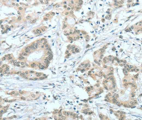 Anti-Human/Mouse ASH2L Antibody