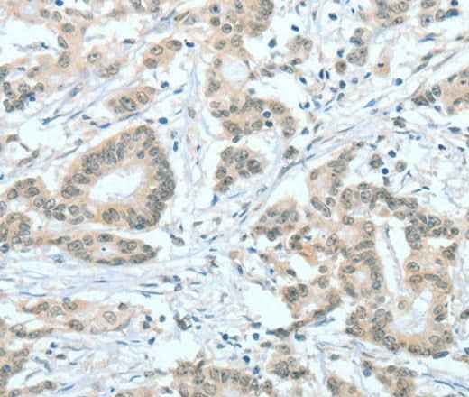 Anti-Human/Mouse ASH2L Antibody