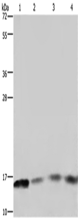 Anti-Human/Mouse/Rat FIS1 Antibody - ABMIUM