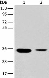 Anti-Human/Mouse/Rat RGN Antibody - ABMIUM