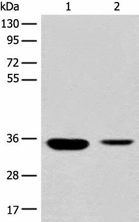 Anti-Human/Mouse/Rat RGN Antibody - ABMIUM