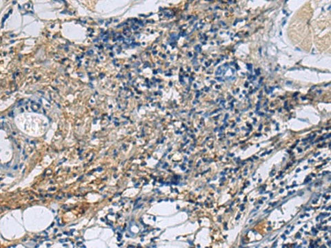 Immunohistochemistry of paraffin-embedded Human tonsil tissue using PROC Polyclonal Antibody at dilution of 1:100(×200)