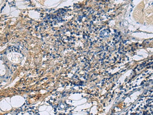 Immunohistochemistry of paraffin-embedded Human tonsil tissue using PROC Polyclonal Antibody at dilution of 1:100(×200)
