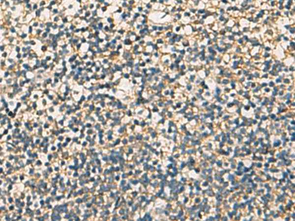 Anti-Human/Mouse/Rat STX6 Antibody