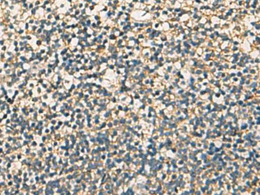Anti-Human/Mouse/Rat STX6 Antibody