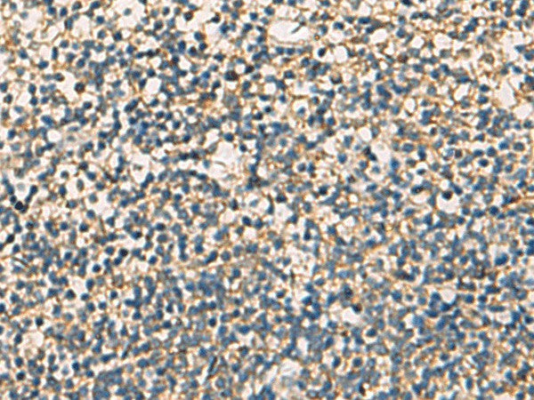 Immunohistochemistry of paraffin-embedded Human tonsil tissue using STX6 Polyclonal Antibody at dilution of 1:60(×200)