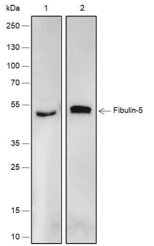 Anti-Human Fibulin-5 Antibody [A566] - ABMIUM