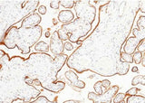 Anti-Human LIFR Antibody [A1189] - ABMIUM