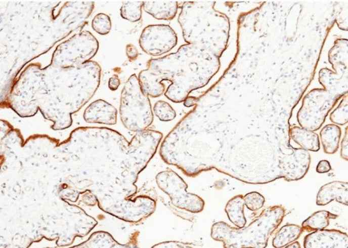 Anti-Human LIFR Antibody [A1189] - ABMIUM