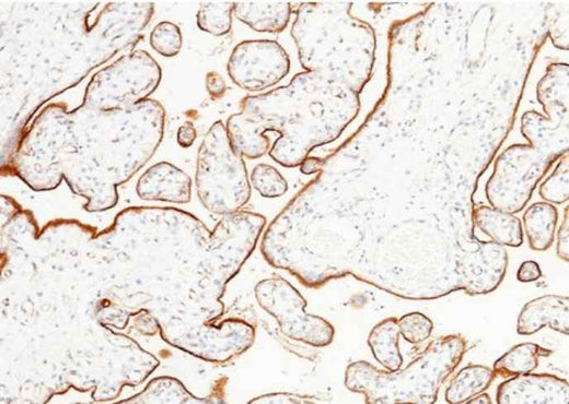 Anti-Human LIFR Antibody [A1189] - ABMIUM