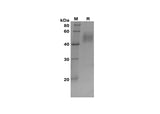 SDS-PAGE analysis of Rat IGFBP-3 proteins, 2 μg/lane of Recombinant Rat IGFBP-3 proteins was resolved with SDS-PAGE under reducing conditions, showing bands at 42-55 kDa.