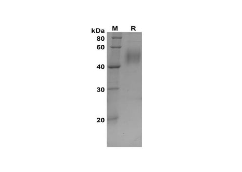 SDS-PAGE analysis of Rat IGFBP-3 proteins, 2 μg/lane of Recombinant Rat IGFBP-3 proteins was resolved with SDS-PAGE under reducing conditions, showing bands at 42-55 kDa.