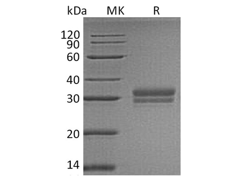 Recombinant Human VSIG2 Protein (His Tag) - ABMIUM