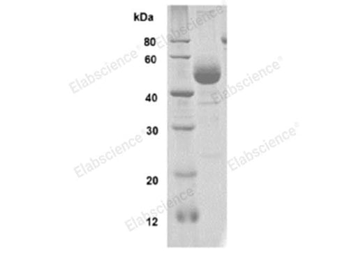 SDS-PAGE analysis of Human IL-6 proteins, 2 μg/lane of Recombinant Human IL-6 proteins was resolved with SDS-PAGE under reducing conditions, showing bands at 45-55 kDa.