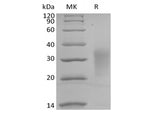 Recombinant Human Interleukin-13/IL-13 (C-Avi-6His) Biotinylated - ABMIUM