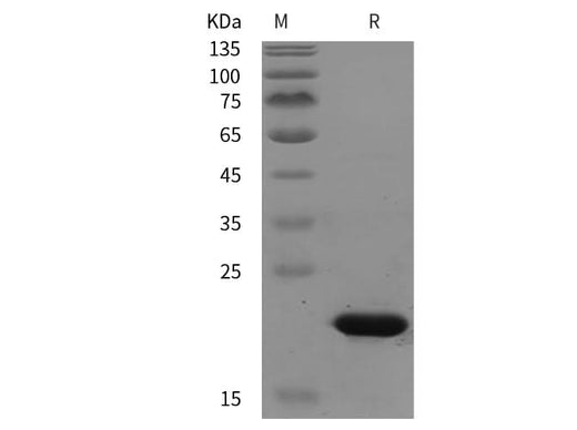 SDS-PAGE analysis of Bovine TGFBR1 proteins, 2 μg/lane of Recombinant Bovine TGFBR1 proteins was resolved with SDS-PAGE under reducing conditions, showing bands at 20 kDa.