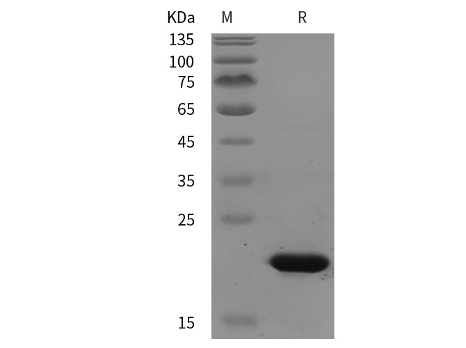 SDS-PAGE analysis of Bovine TGFBR1 proteins, 2 μg/lane of Recombinant Bovine TGFBR1 proteins was resolved with SDS-PAGE under reducing conditions, showing bands at 20 kDa.