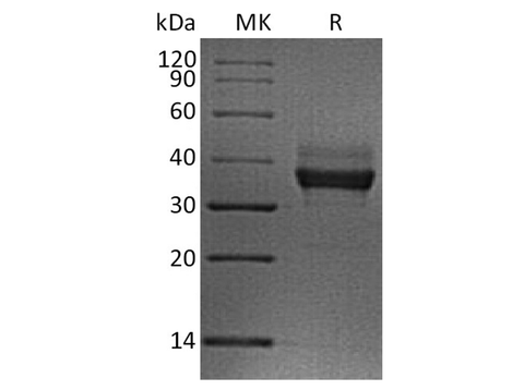 Recombinant Human LILRB4/CD85k/ILT3 Protein (His Tag) - ABMIUM