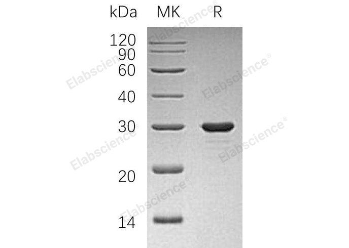 Recombinant Human PDAP1/PAP Protein (His Tag) - ABMIUM