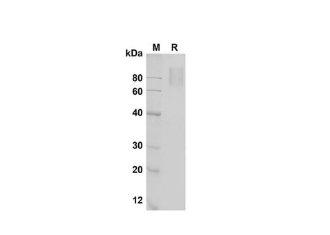 SDS-PAGE analysis of Mouse IL-17 RA/IL-17 R proteins , 2 μg/lane of Recombinant Mouse IL-17 RA/IL-17 R proteins was resolved with SDS-PAGE under reducing conditions , showing bands at 80 kDa.