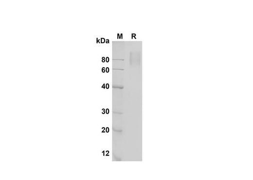 SDS-PAGE analysis of Mouse IL-17 RA/IL-17 R proteins , 2 μg/lane of Recombinant Mouse IL-17 RA/IL-17 R proteins was resolved with SDS-PAGE under reducing conditions , showing bands at 80 kDa.