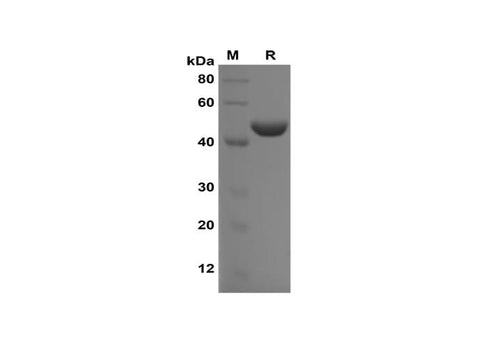 SDS-PAGE analysis of Rat IL-2 proteins,2 μg/lane of Recombinant Rat IL-2 proteins,was resolved with SDS-PAGE under reducing conditions,showing bands at 45-50 kDa.