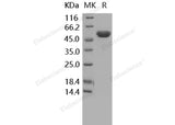 Recombinant Human TIMP2/TIMP-2 Protein (Fc Tag) - ABMIUM