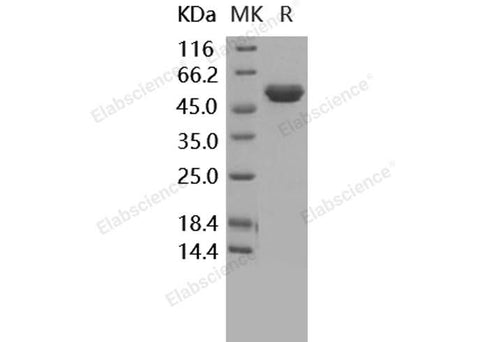 Recombinant Human TIMP2/TIMP-2 Protein (Fc Tag) - ABMIUM