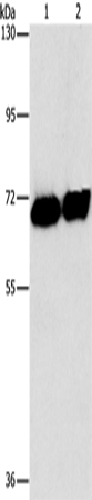 Anti-Human ALPP Antibody - ABMIUM