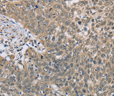 Anti-Human/Mouse DACH2 Antibody - ABMIUM