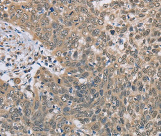 Anti-Human/Mouse DACH2 Antibody - ABMIUM
