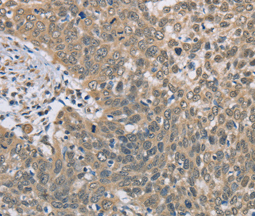 Anti-Human/Mouse DACH2 Antibody - ABMIUM