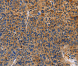 Anti-Human/Mouse/Rat MUSK Antibody - ABMIUM