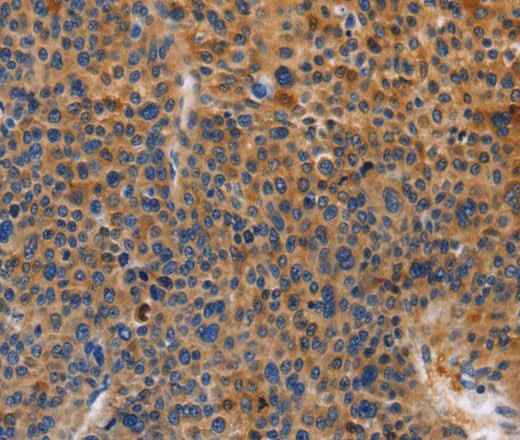 Anti-Human/Mouse/Rat MUSK Antibody