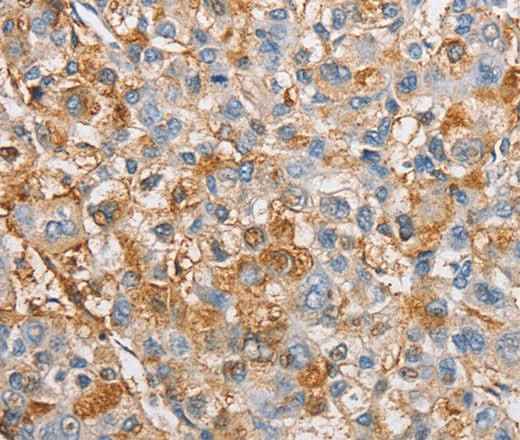 Anti-Human/Mouse/Rat IKBKG Antibody
