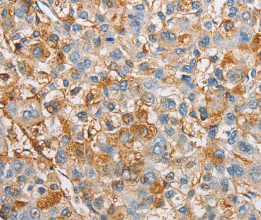 Anti-Human/Mouse/Rat IKBKG Antibody - ABMIUM