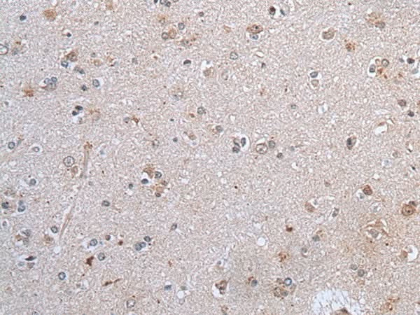 Immunohistochemistry of paraffin-embedded Human brain tissue using CLDN12 Polyclonal Antibody at dilution of 1:45(×200)