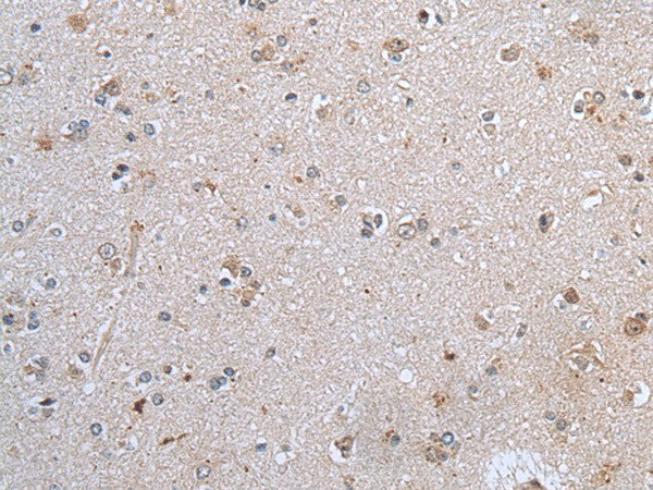 Immunohistochemistry of paraffin-embedded Human brain tissue using CLDN12 Polyclonal Antibody at dilution of 1:45(×200)
